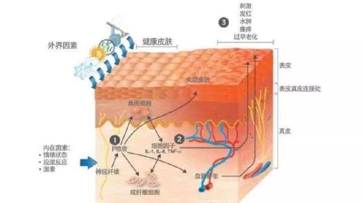 黔西南布依族苗族自治州“屏障修復(fù)”修復(fù)的是什么？不同膚質(zhì)該如何搭配？